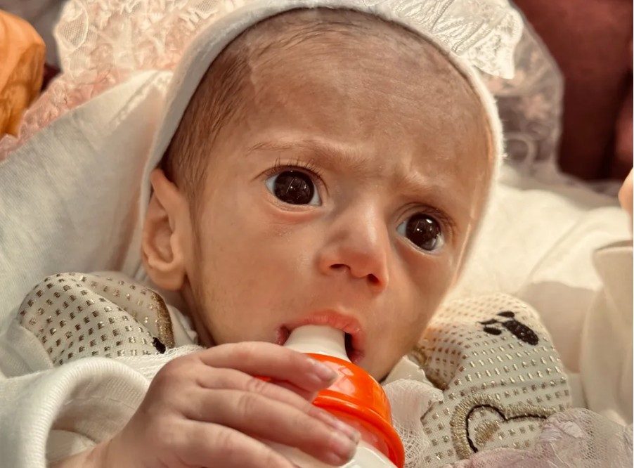 Malnourished baby, Siwar evacuated from Gaza