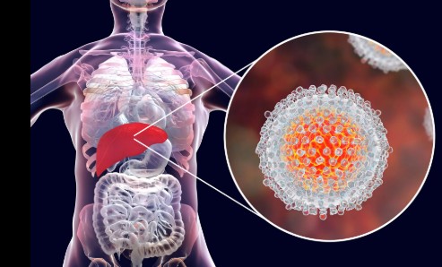 FG Launches Project 365 to eliminate Hepatitis by 2030