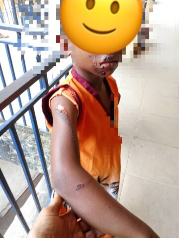 Imo State police arrest woman for cruel treatment of 7 year old girl